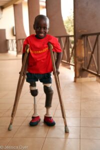 Santigi, who has prosthetic legs