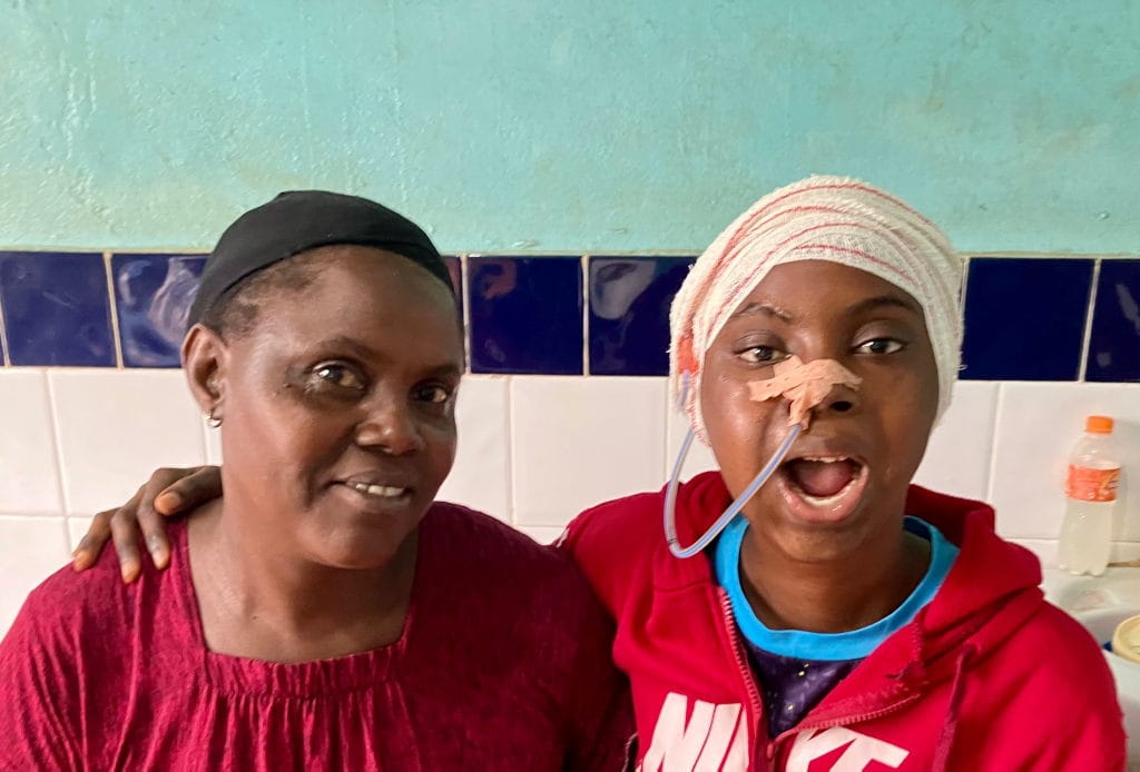 Yelikha from Guinea before her operation