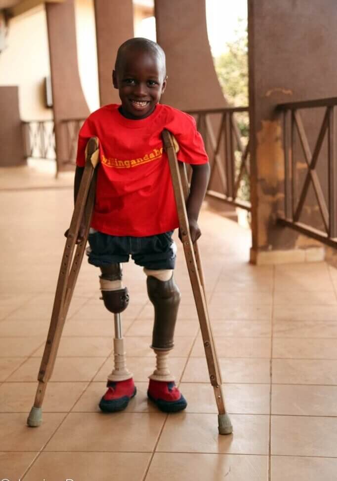 Santigi, who has prosthetic legs